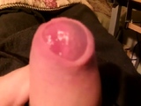foreskin stretching,phimosis sucks