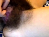 Extremely hairy!
